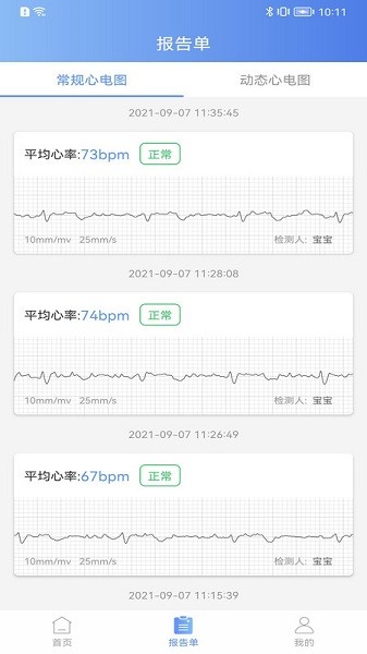 卡帕奇心电图2